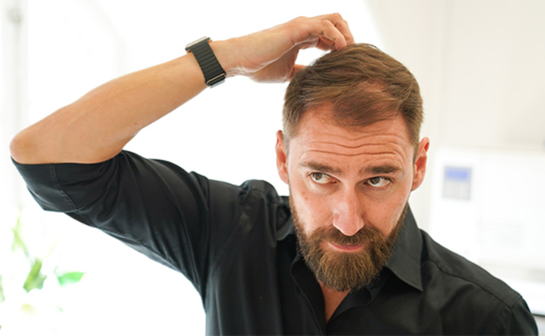 De bästa shampona för hårväxt